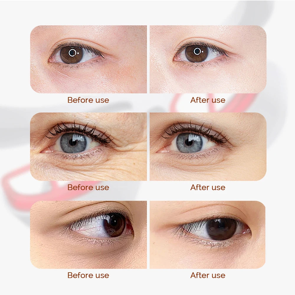 Lumina 3D Eye Massage Device